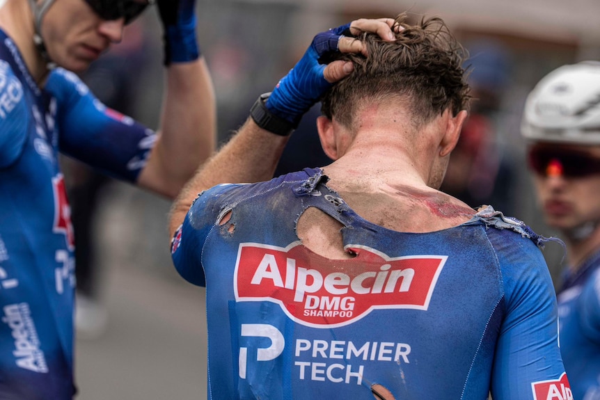 A dark-haired man in torn cycling gear, bruised and battered.