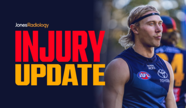 Injury Update: Sid Draper