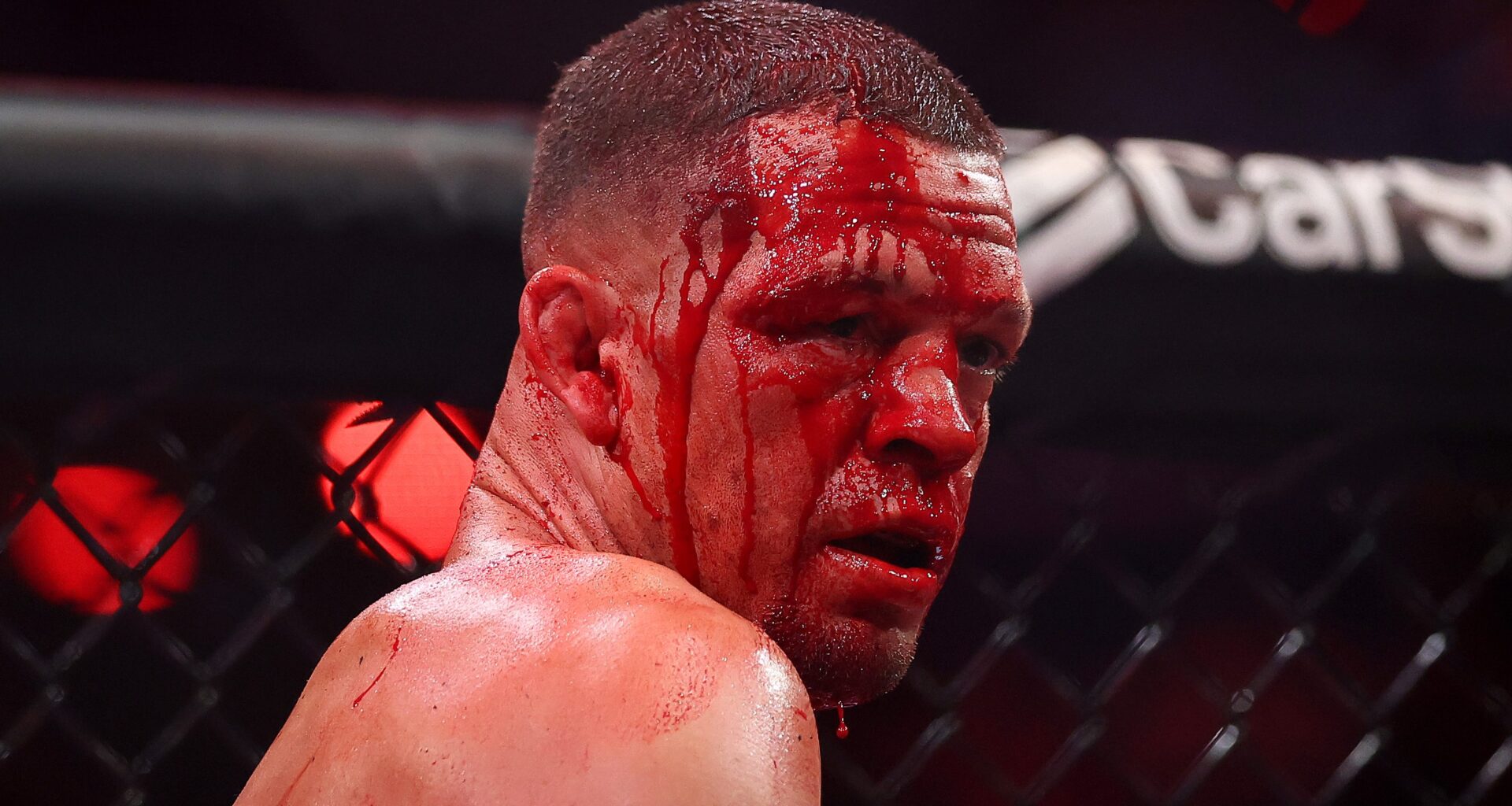 Nate Diaz Responds to Critics Saying He Should Retire From MMA