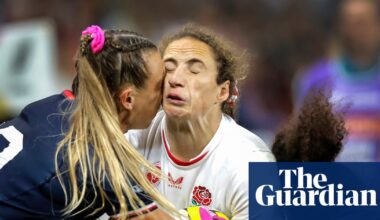 Pioneering study aims to find out how repeated blows to head in women’s rugby affects brain | Sports science