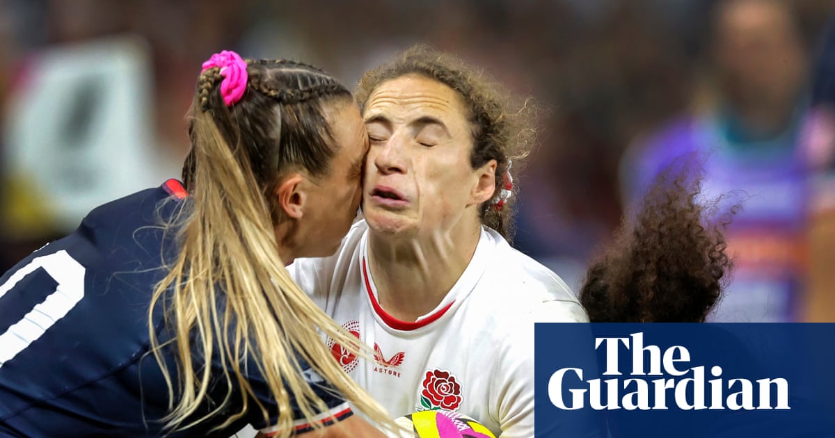 Pioneering study aims to find out how repeated blows to head in women’s rugby affects brain | Sports science