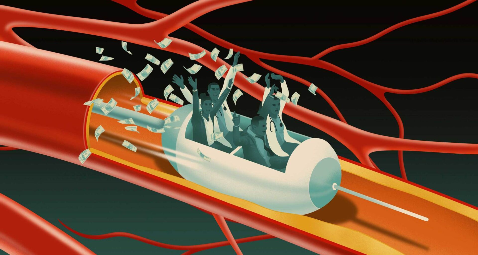 More Than $100M Billed for Questionable Vascular Procedures, IG Report Finds — ProPublica
