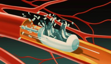 More Than $100M Billed for Questionable Vascular Procedures, IG Report Finds — ProPublica