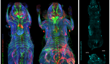 A deep-learning framework reveals whole-body perturbations at cell level