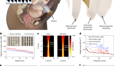 Fetal monitoring for high-risk pregnancies using a wearable ultrasound patch