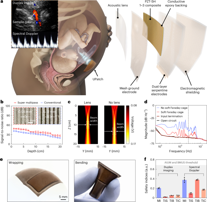Fetal monitoring for high-risk pregnancies using a wearable ultrasound patch