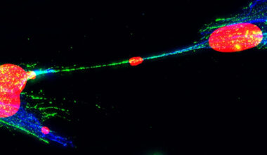 Scientists find damaged DNA can jump between human cells in possible new cancer pathway