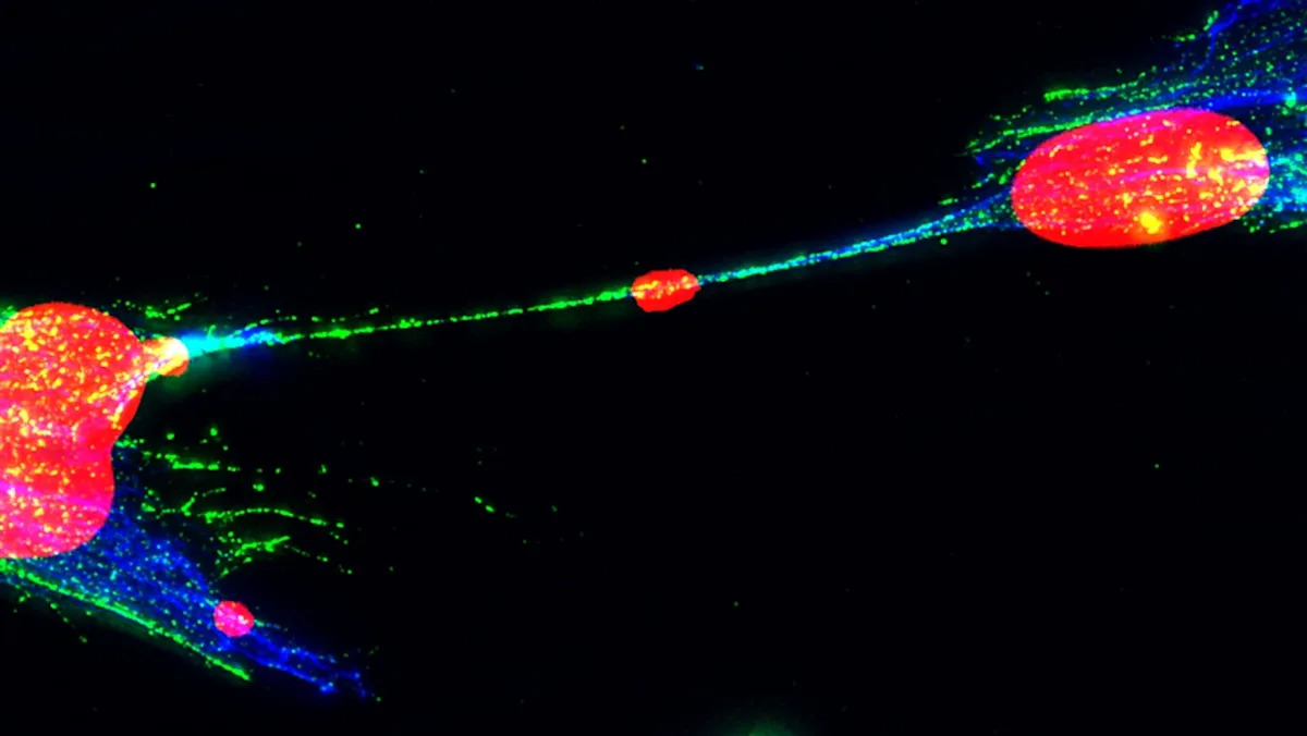 Scientists find damaged DNA can jump between human cells in possible new cancer pathway