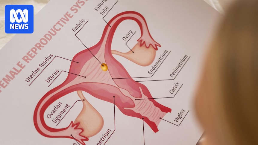 Polycystic ovary syndrome renamed polyendocrine metabolic ovarian syndrome