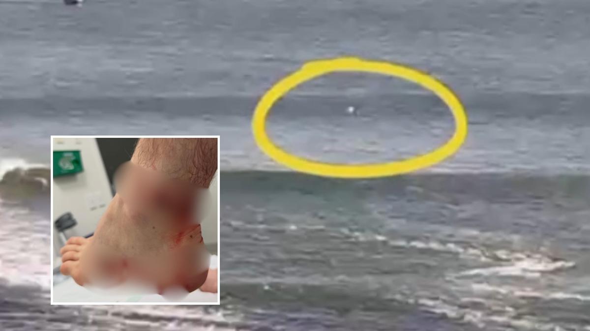CCTV footage emerges after wounded Aussie photographer Ed Sloane attacked in the water