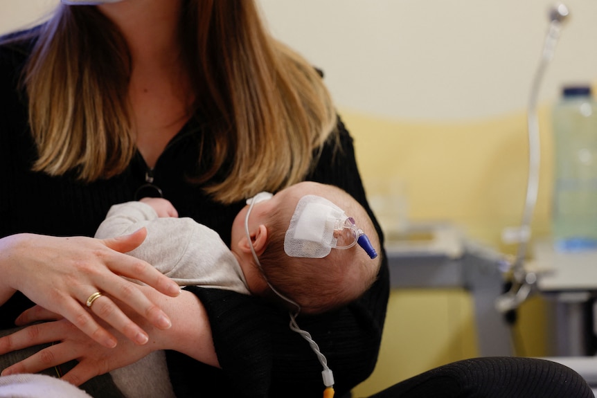 A woman holds a child with medical equipment taped to its head