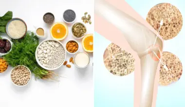 Increasing bone strength with food: Nutritionist Sarah Di Lorenzo’s advice on what to eat