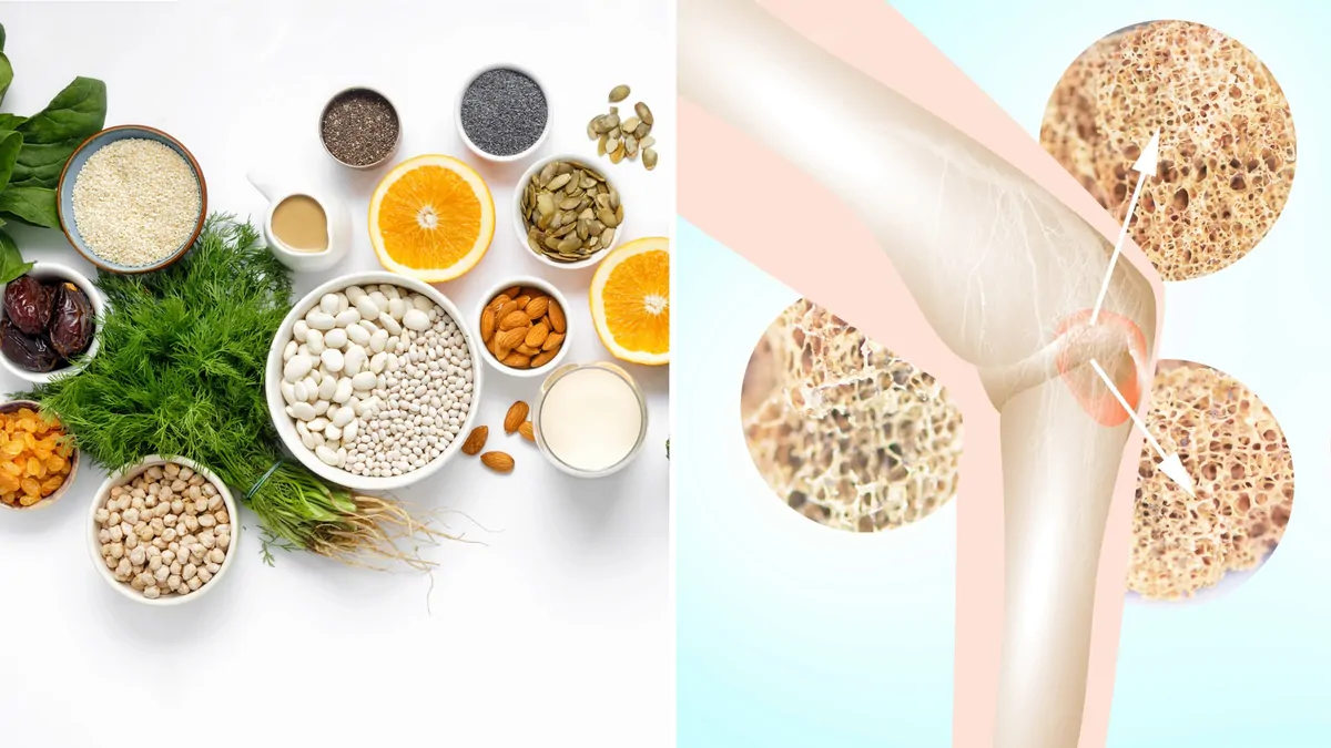 Increasing bone strength with food: Nutritionist Sarah Di Lorenzo’s advice on what to eat