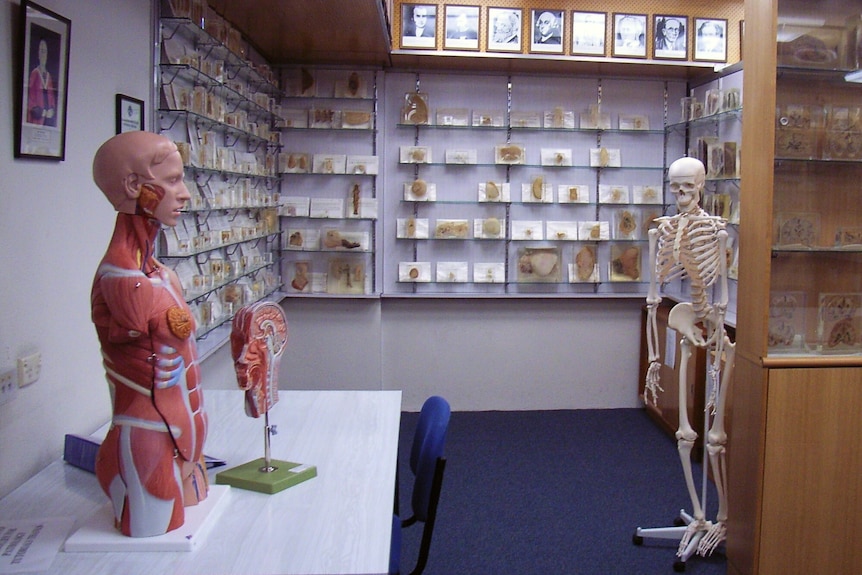 Slices of body parts covered in Perspex and put on display on walls.