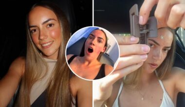 Australian TikTokker Bianca Dilworth’s warning after she had metal removed from her leg when claw clip broke