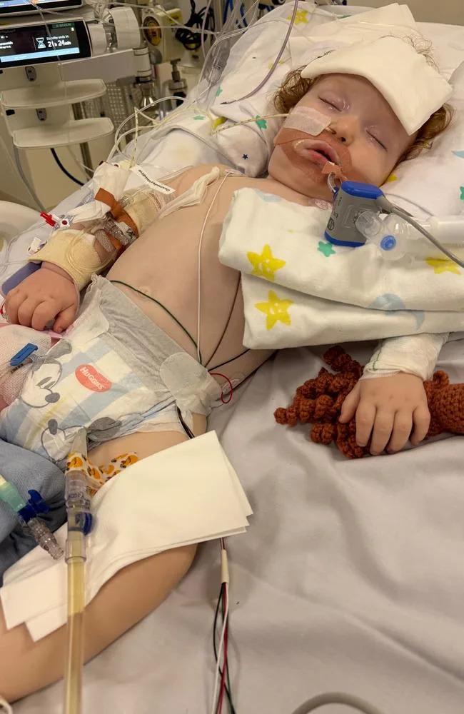 Toddler in an induced coma and unable to breathe on his own after a shocking baking accident. Picture: GoFundMe