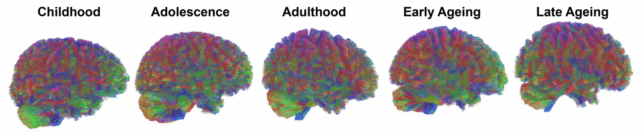 Brain Scans Eras