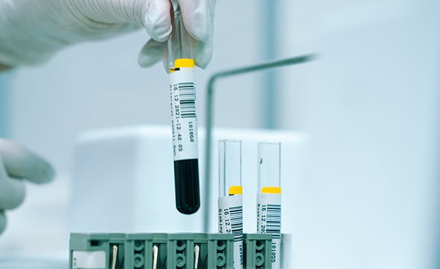 Blood test