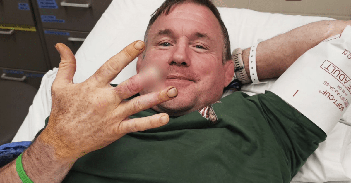 Matt Hughes reveals finger amputation with humorous post