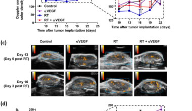 Tumor vasculature response to radiotherapy (RT) and anti-VEGF therapy