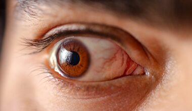Spinach-Based Eye Drops Could Help Treat a Common Eye Condition : ScienceAlert