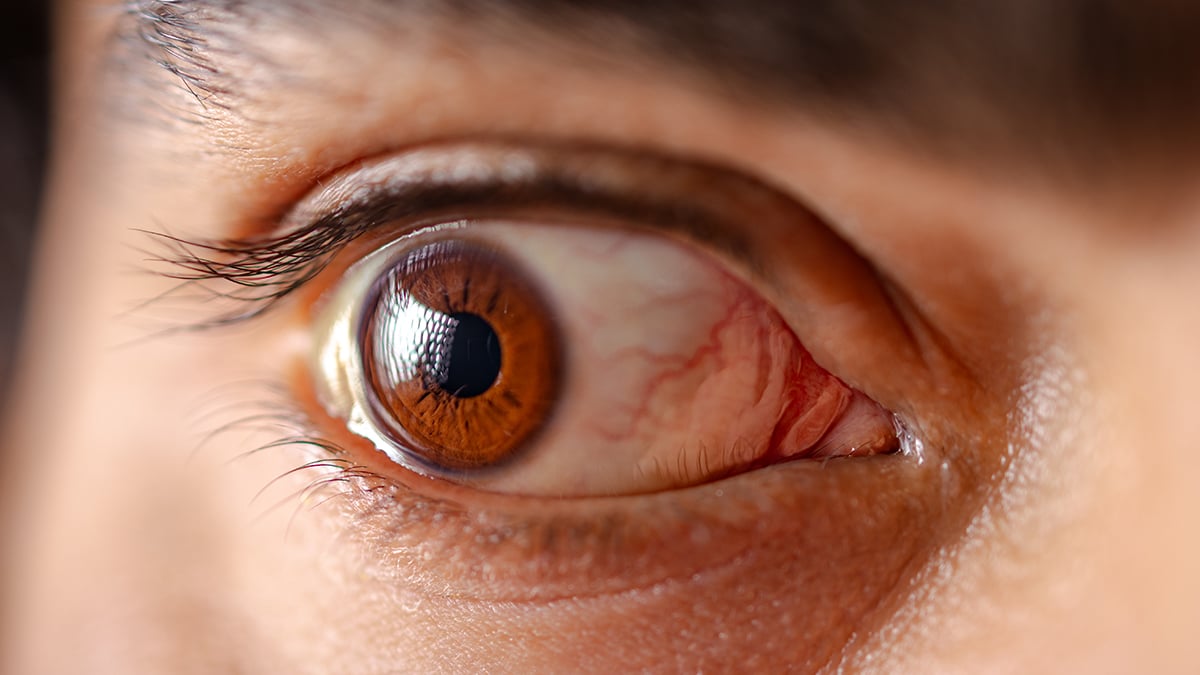 Spinach-Based Eye Drops Could Help Treat a Common Eye Condition : ScienceAlert