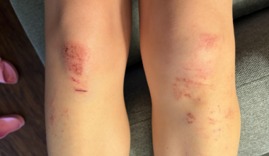"You haven't ridden clipless until you've fallen on your face at 1mph... usually in front of a thousand strangers": An age-old cycling rite of passage still going strong... as this now-embarrassed rider found out + more on the live blog - Cycling News | Bike Reviews