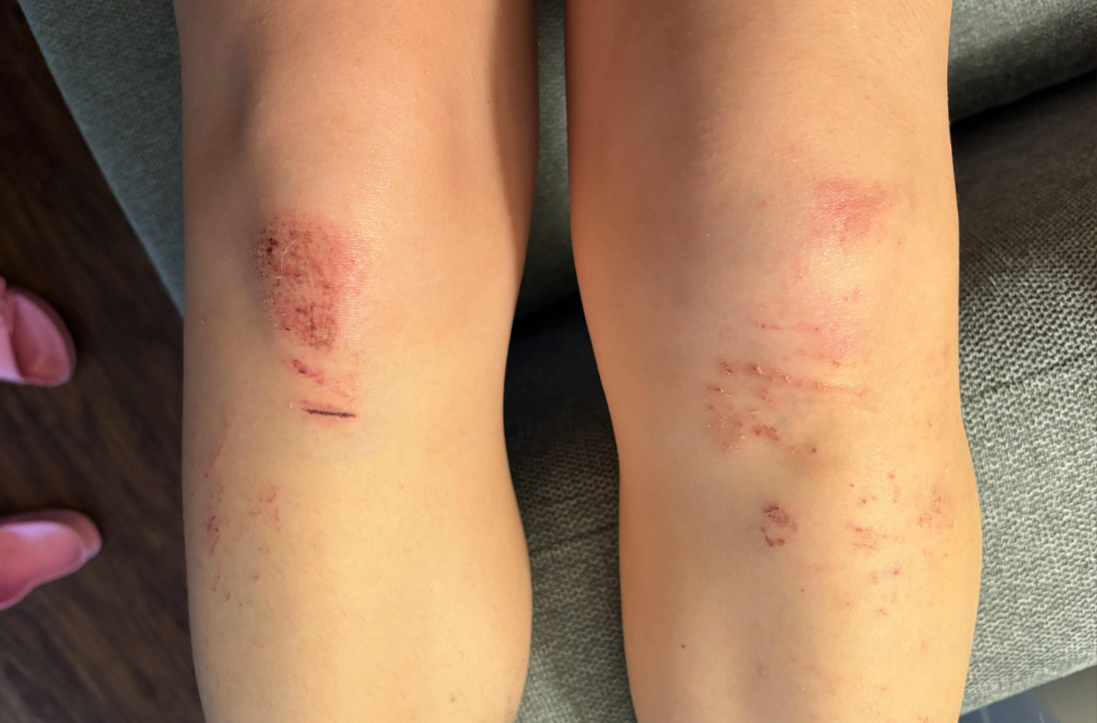 "You haven't ridden clipless until you've fallen on your face at 1mph... usually in front of a thousand strangers": An age-old cycling rite of passage still going strong... as this now-embarrassed rider found out + more on the live blog - Cycling News | Bike Reviews