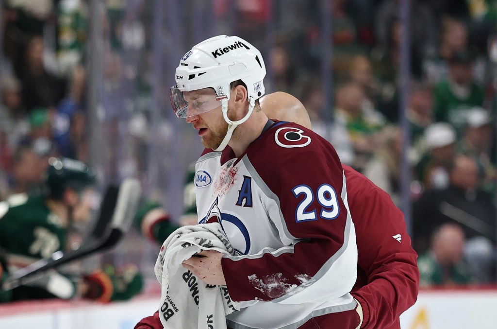 Avs star takes puck to face, returns to Game 4