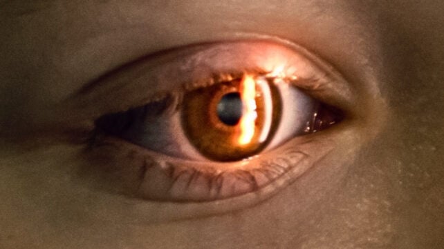Close zoom of an eye undergoing a visual field test, with light shining into the iris.