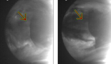 A Gigantic Atmospheric Anomaly Keeps Showing Up on Venus. Astronomers Finally Know Why