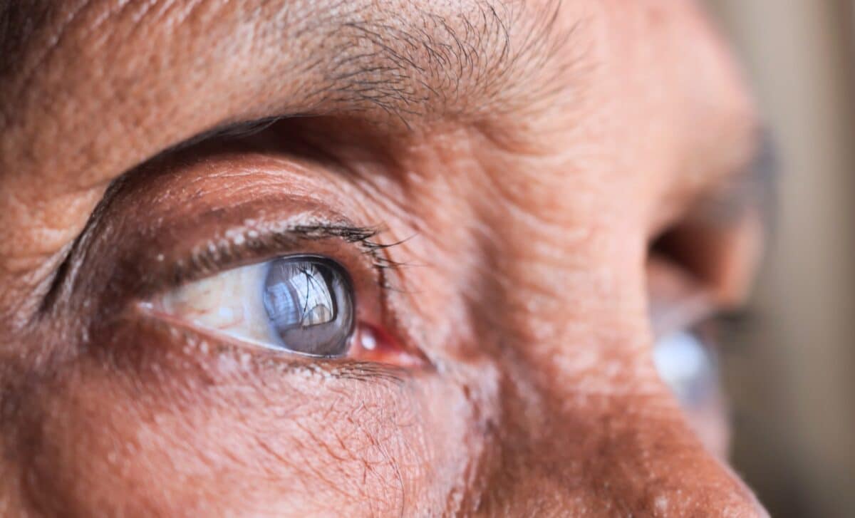 Why More Eye Specialists Are Recommending Supplements For Better Vision Health