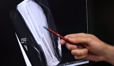 Montreal study sheds light on vitamin K’s role in bone strength