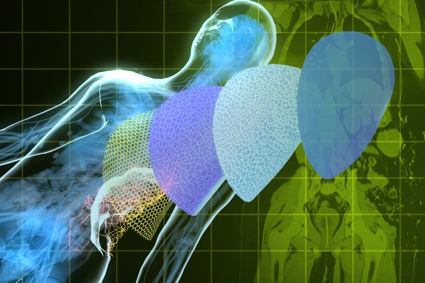 A graphic of a human body overlayed with various coloured meshes