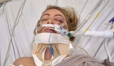 Melton e-scooter hit-run: Mum Tania Kerr fighting for life