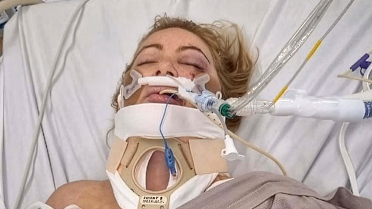 Melton e-scooter hit-run: Mum Tania Kerr fighting for life