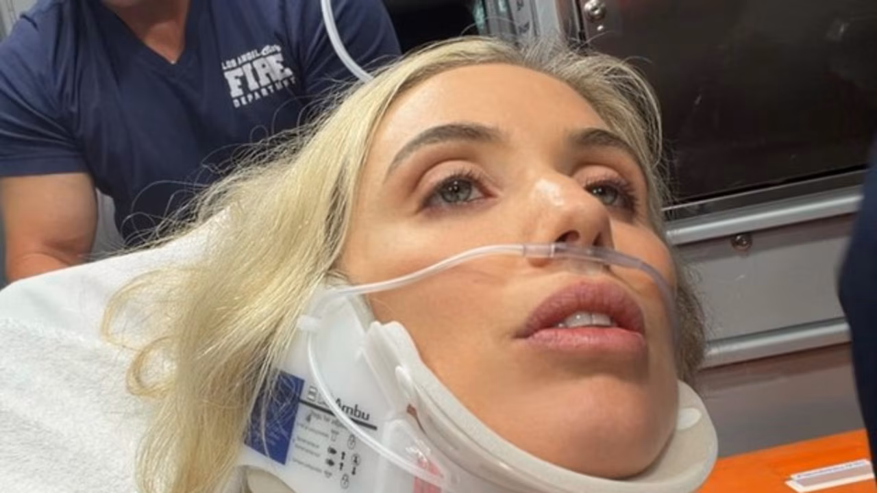 US comedian Laura Clery ‘nearly killed’ in horror accident at home