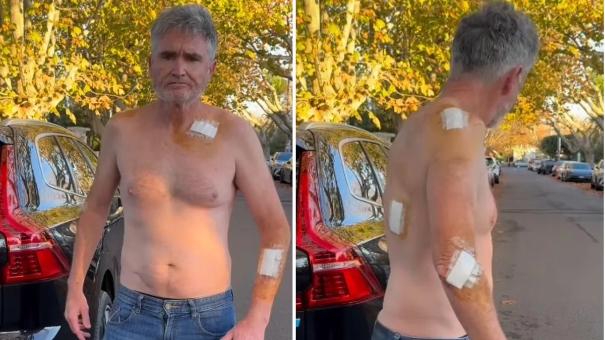 Dave Hughes cancer shock: Aussie comedian requires 45 stitches after surgery