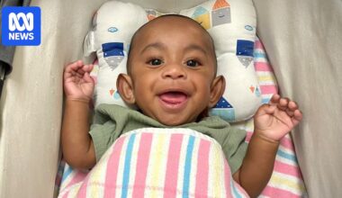 The race to save a conjoined twin