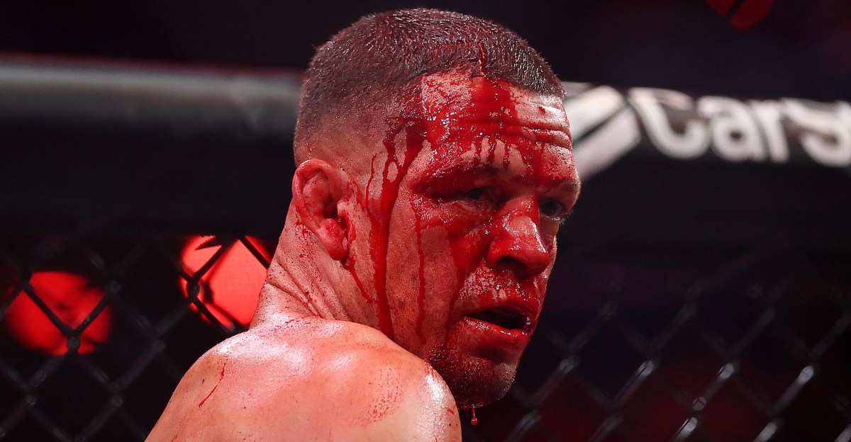 Nate Diaz scoffs at calls for retirement after Mike Perry loss: ‘This sh*t is forever’