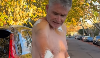 Dave Hughes skin cancer: Hughesy emerges with five bandages, 45 stitches after latest removal