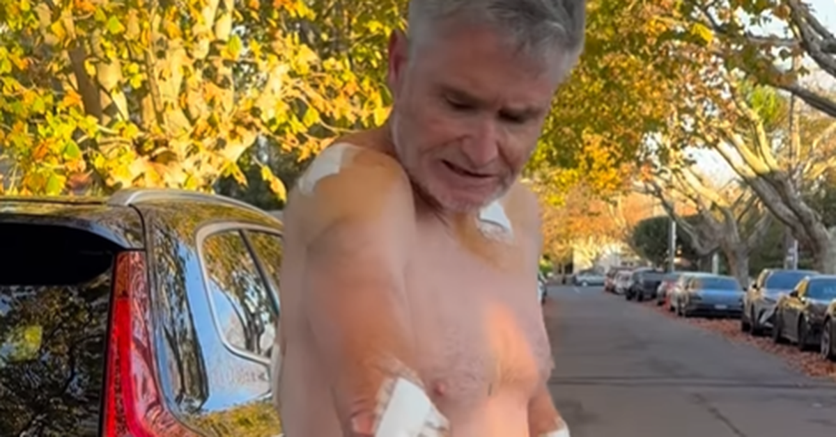 Dave Hughes skin cancer: Hughesy emerges with five bandages, 45 stitches after latest removal