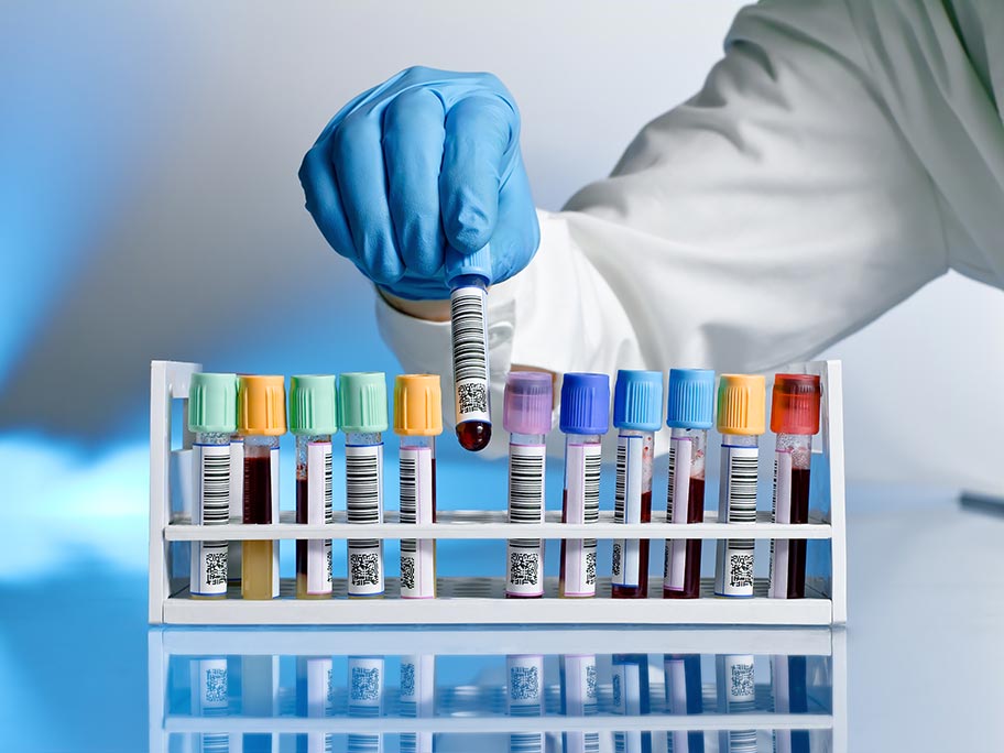 'Nudge letters' reduced GP pathology requests by 42,000 a year: Lancet study
