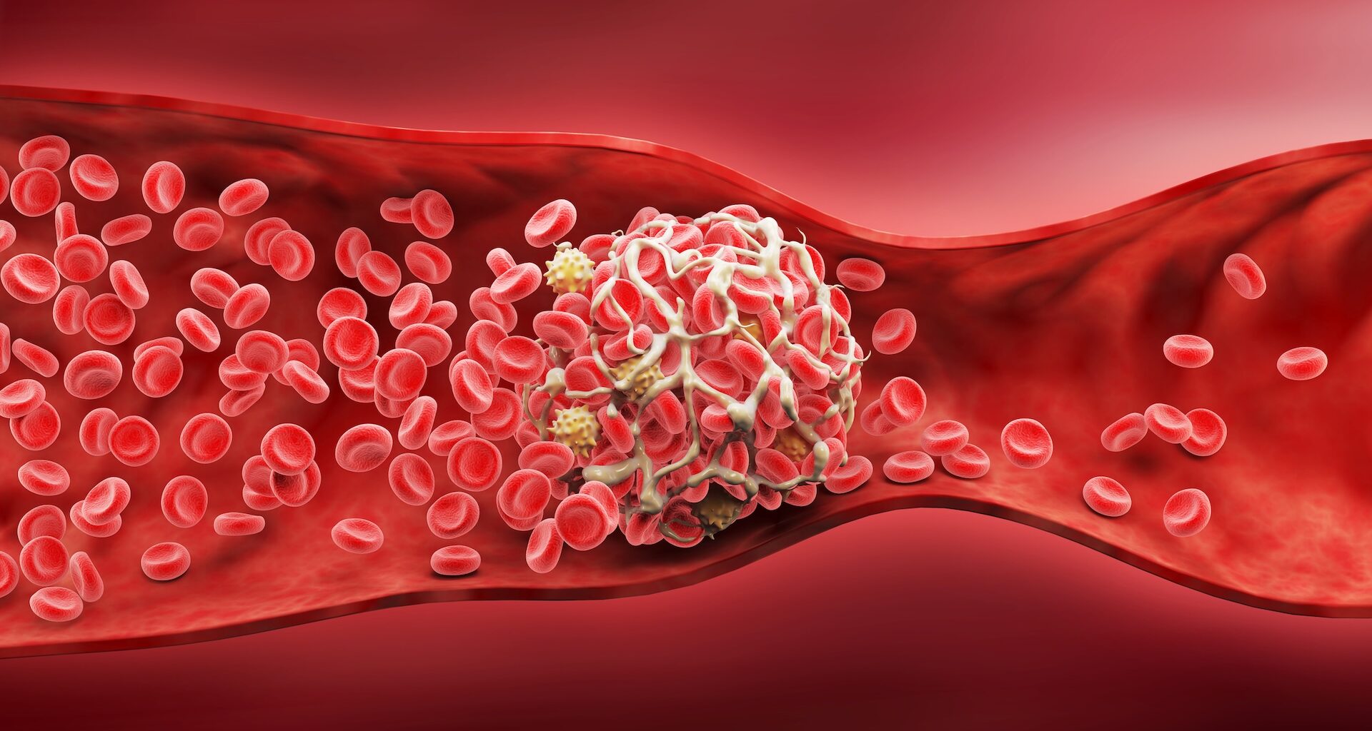 A close-up of red blood cells circulating in a blood vessel with a white blood cell visibly present.