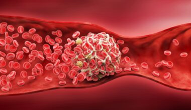 A close-up of red blood cells circulating in a blood vessel with a white blood cell visibly present.