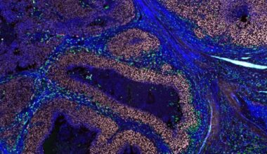 ‘Unexpected and genuinely exciting’: scientists capture immune cells attacking live melanoma