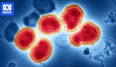 Recorded flu numbers drop drastically but expert warns caution