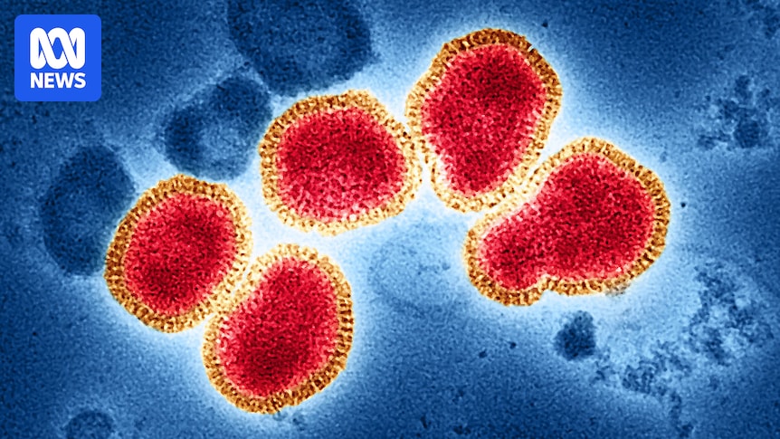 Recorded flu numbers drop drastically but expert warns caution