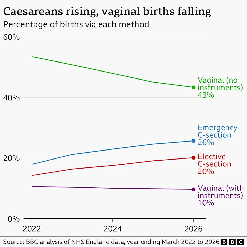 A line graph showing the rise of emergency c-section (26%) from 2022-2026 and the fall in vaginal births to less than half at 43%