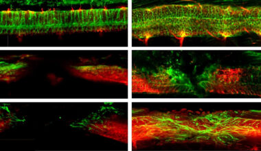 Injectable nanorobots may help heal spinal injuries